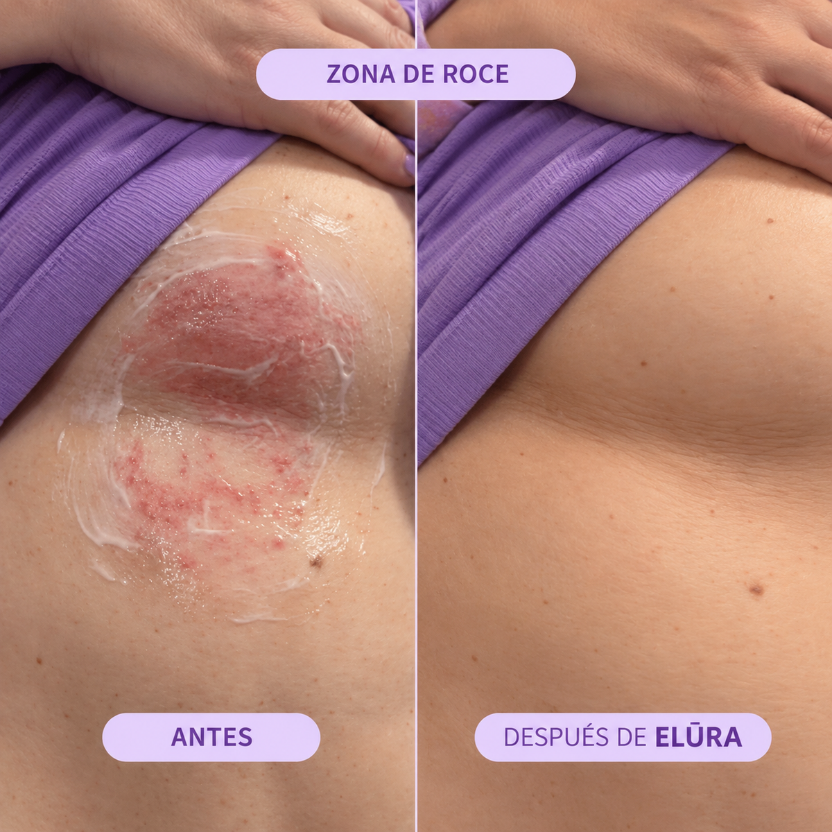 ELURA™ – Roll-On Protector contra el Roce y la Humedad