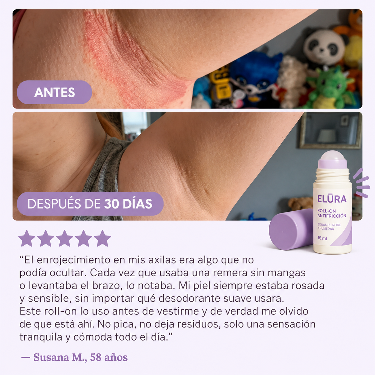 ELURA™ – Roll-On Protector contra el Roce y la Humedad